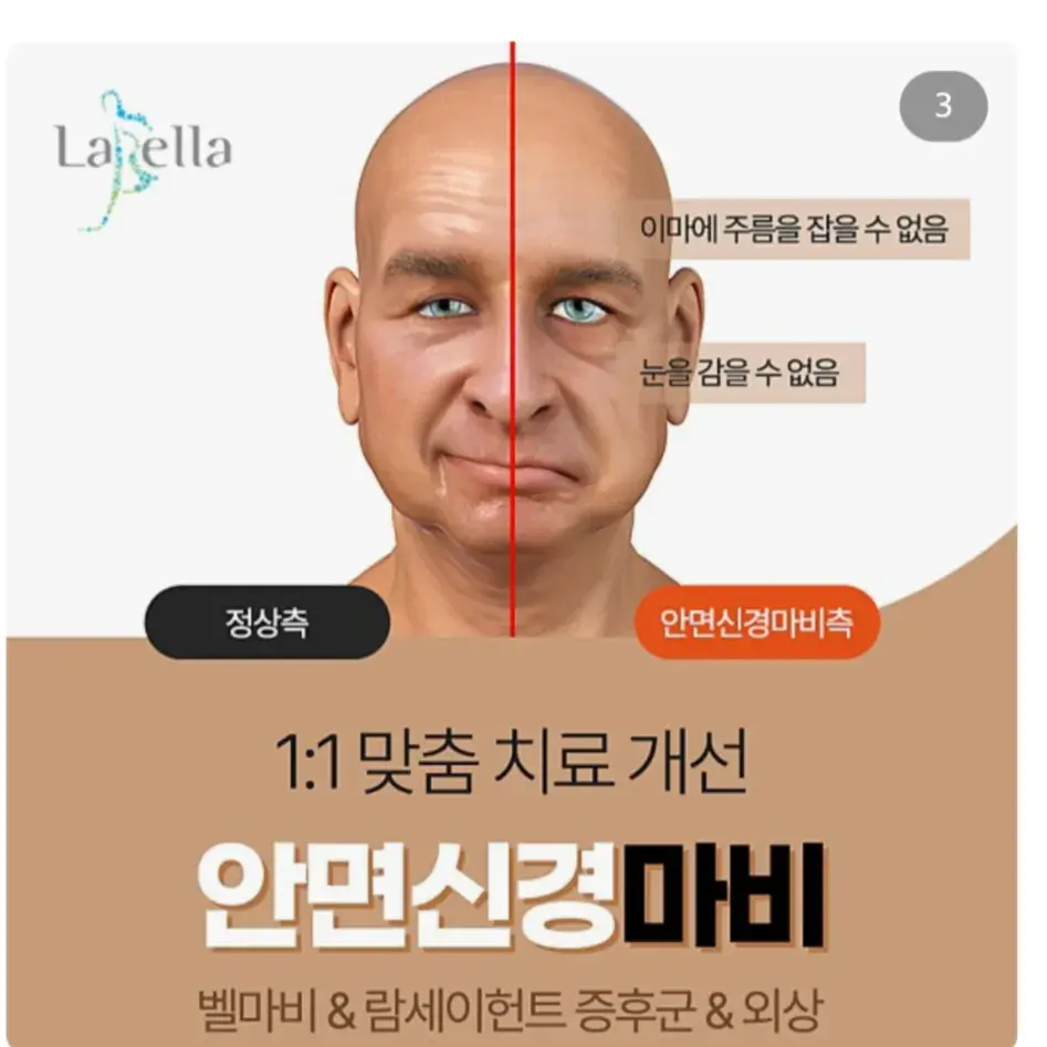 라벨라 안면마비 블로그