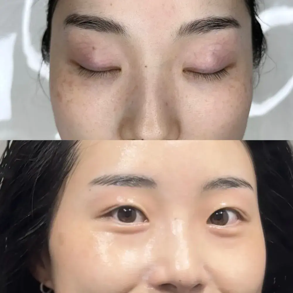 기미뽑기 속기미크림 바로구매