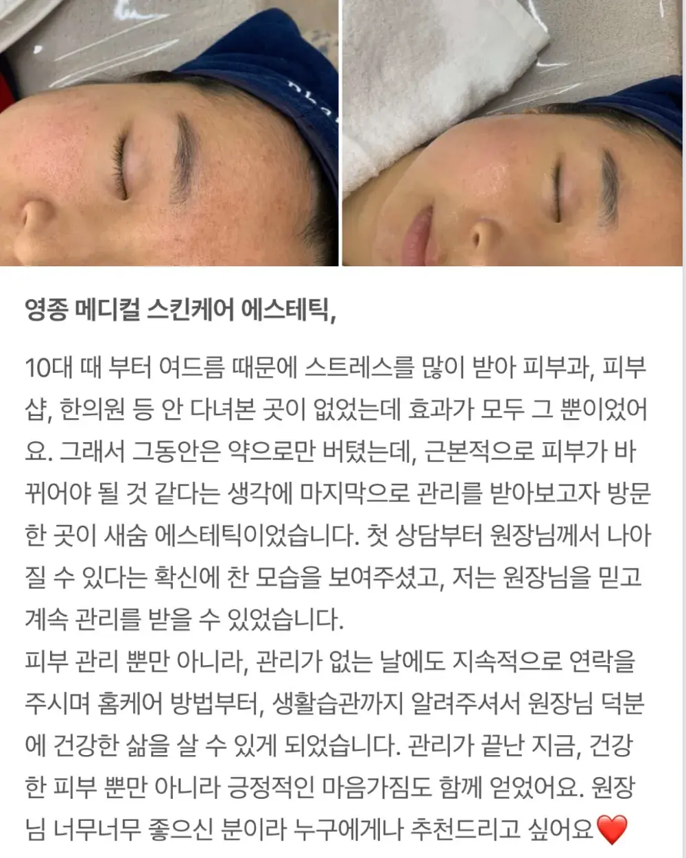 고객님 피부소생 후기