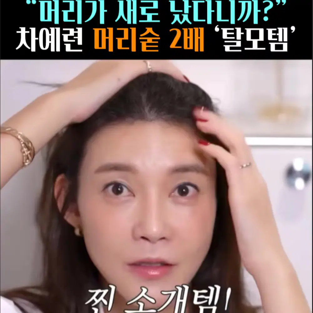 🧚#342. 차예련 머리숱 2배 ‘탈모템’