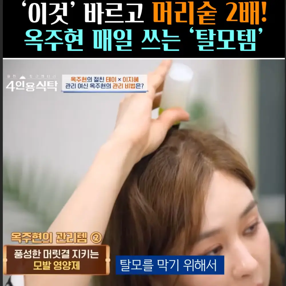 🧚#321. 옥주현, 머리숱2배! ‘탈모템’