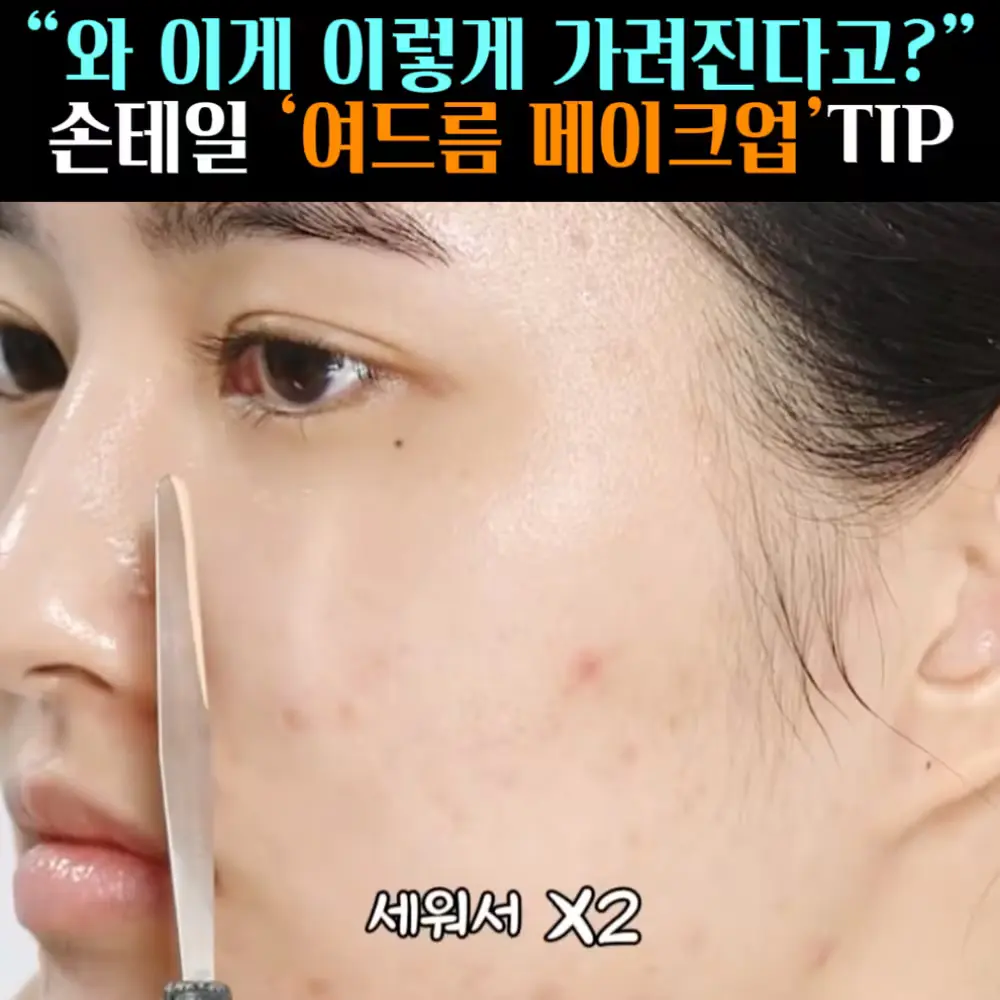 🧚#373. 손테일, 여드름Tip ‘스파출라’