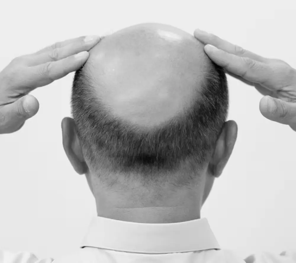 임산부선물 두피 비건 오미연 샴푸 500ml 1개