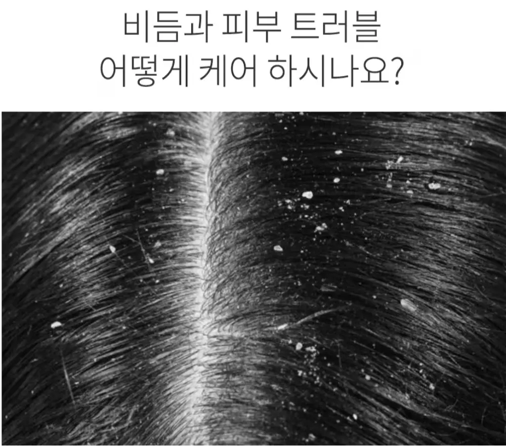 탈모방지 비건 임산부선물 두피관리 비듬케어500mlX3