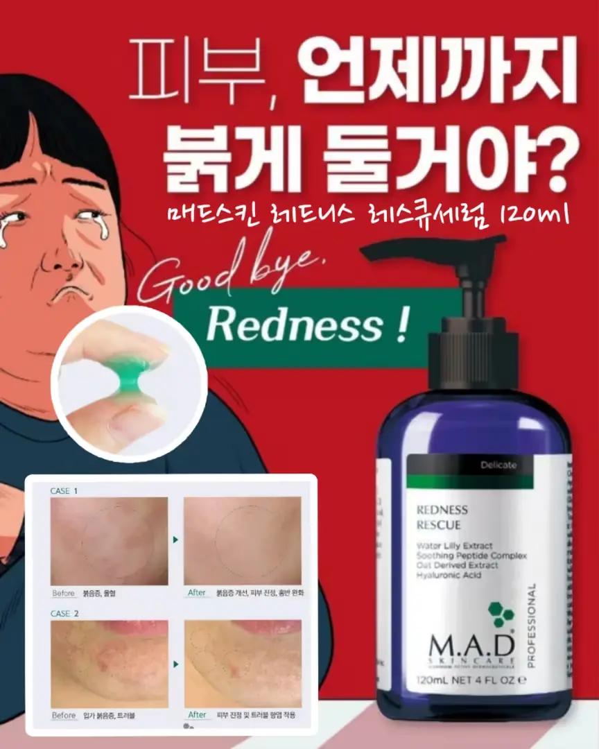 [뷰티유튜버추천템]매드스킨레스큐세럼120ml