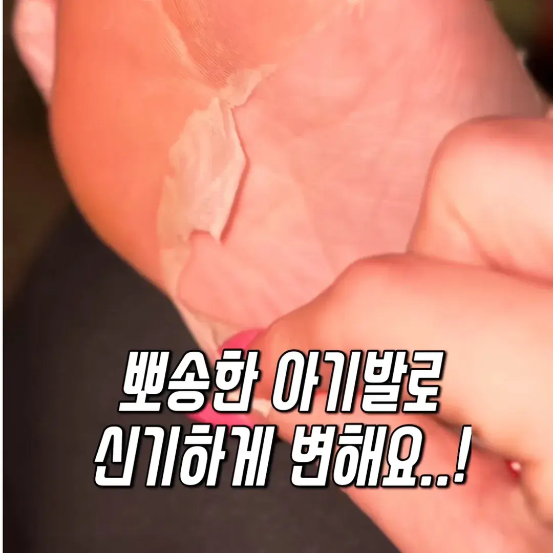 470번-발각질 팩