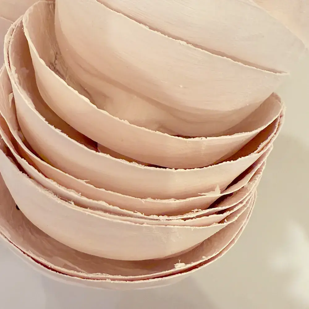 관리 전후 석고본 변화