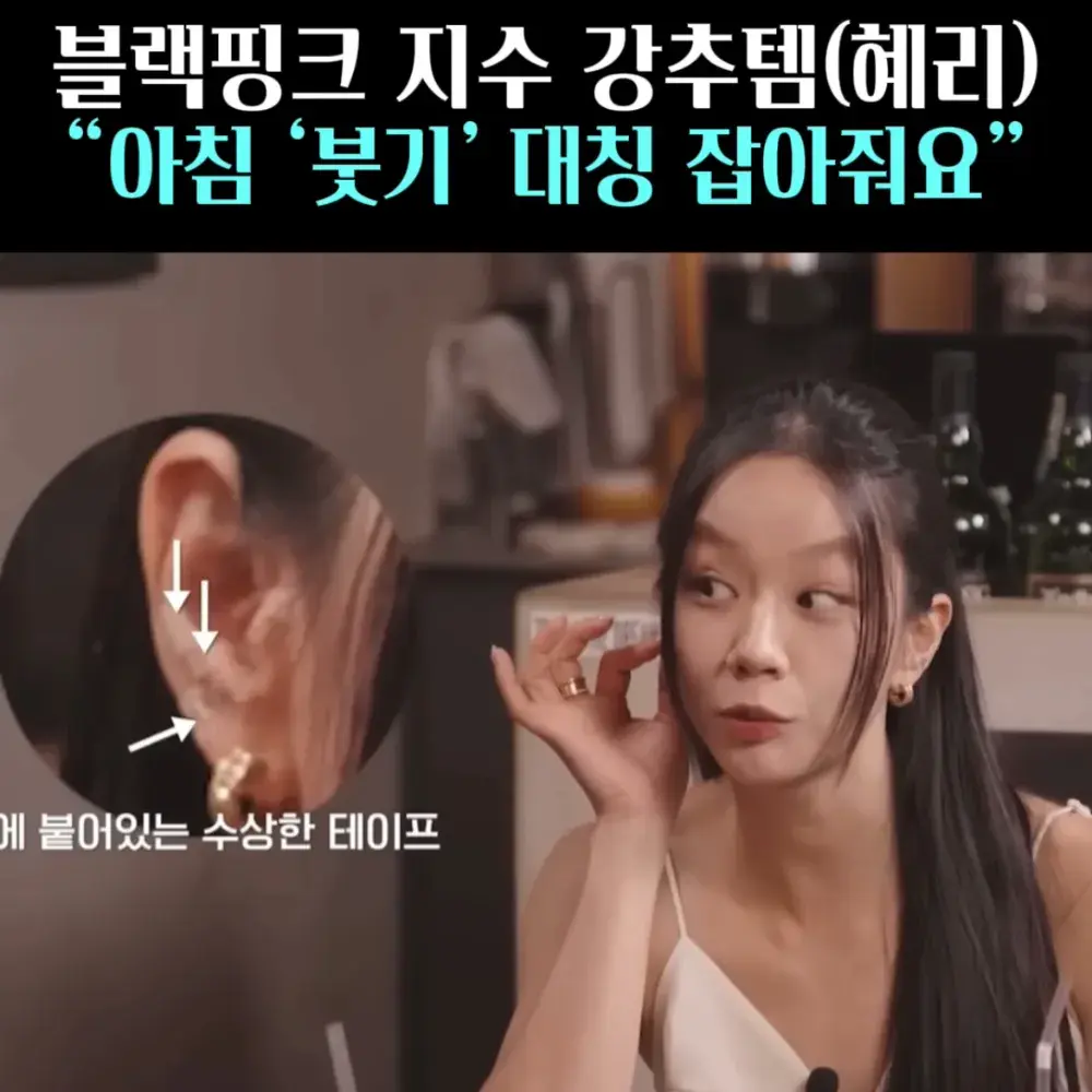 🧚#22. 혜리, 붓기템 ‘이침 패치!’