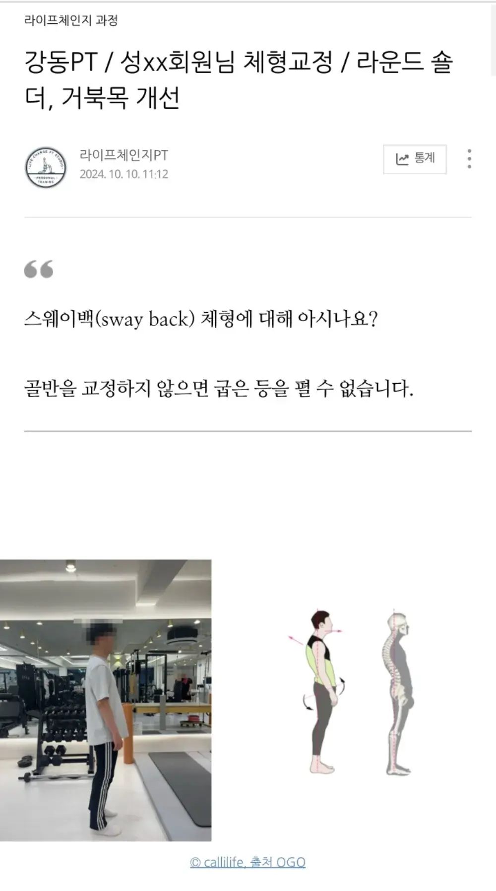 라운드 숄더, 거북목 개선