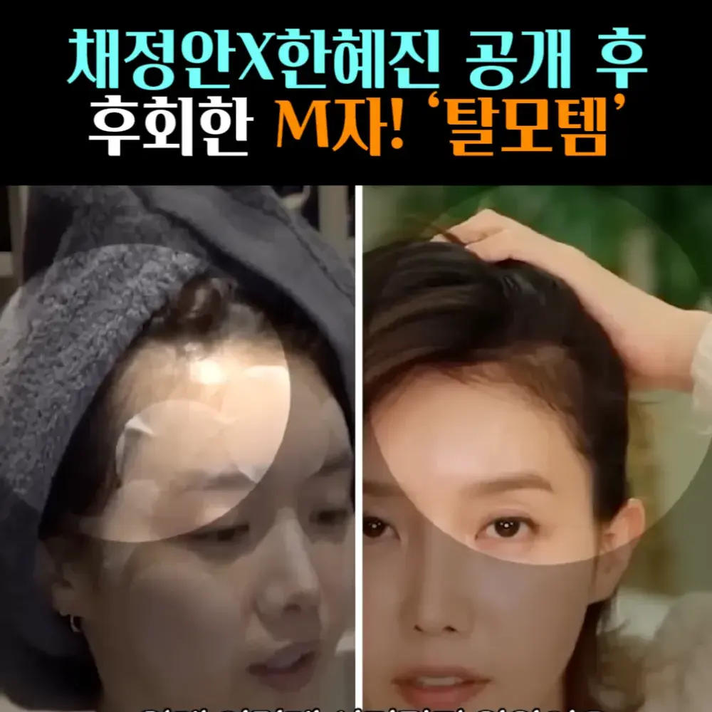 🧚#86. 채정안X한혜진 ‘M자 탈모템’