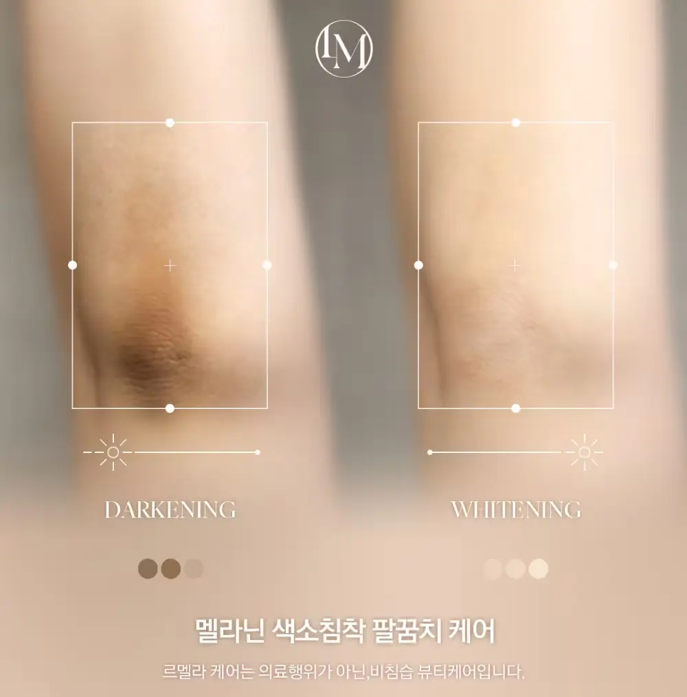 르멜라 멜라닌 케어