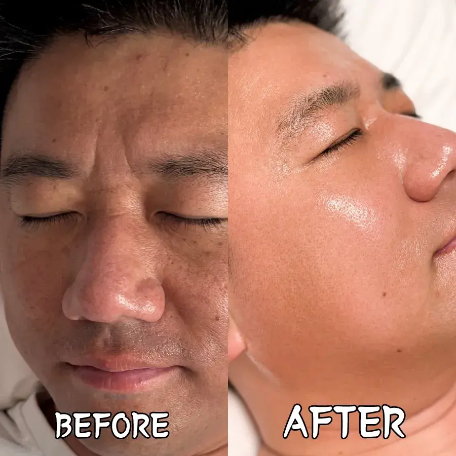 루티너 리뉴얼 할인 커튼콜 시작 !