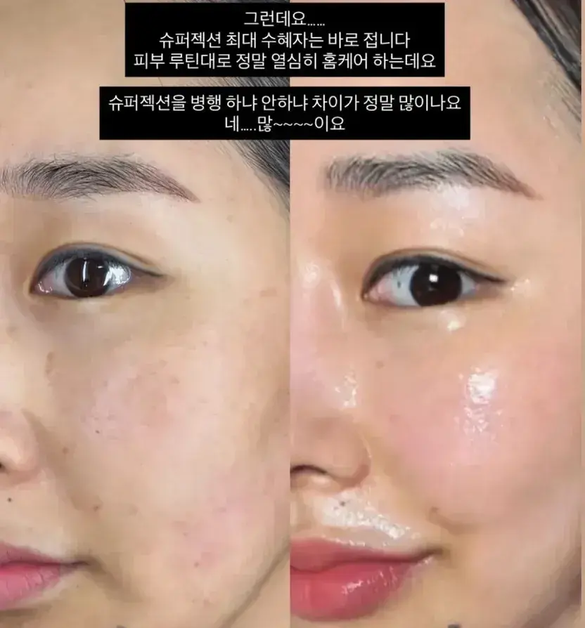 41살 에그대표 셀프 동안비결 [4주 집중관리]