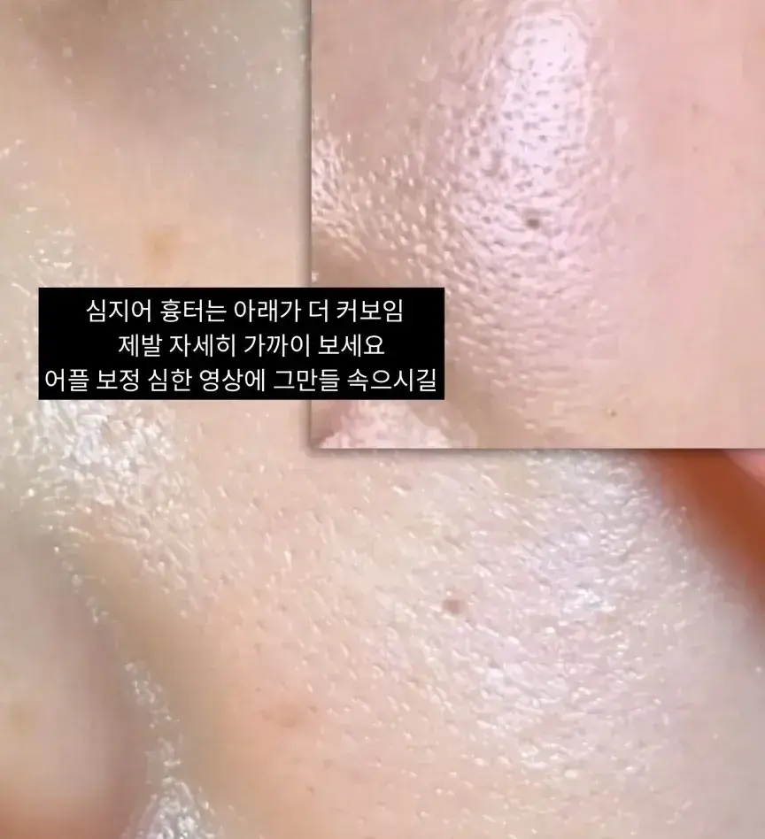 41살 에그대표 셀프 동안비결 [모공키트 4주후]