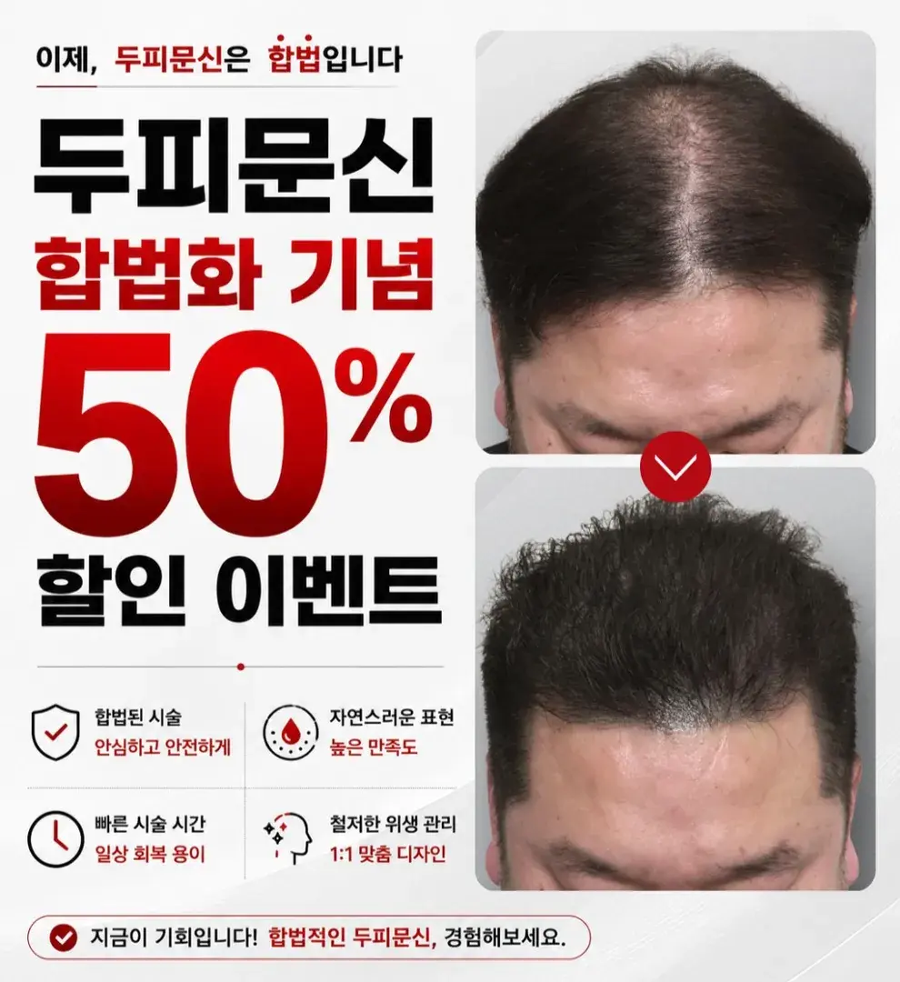 두피문신 고민 중이라면? 실제 후기 보기💬